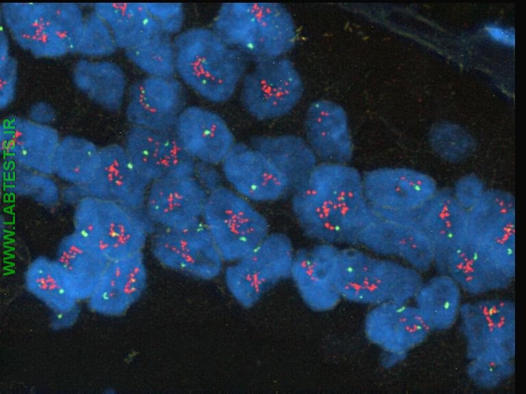 Cells positive for HER2/neu