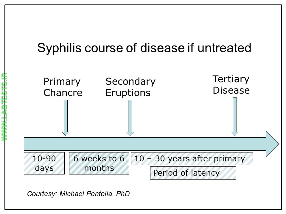 Syphilis stages if left untreated