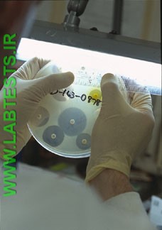 Testing for treatment