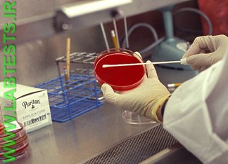 Preparing the culture