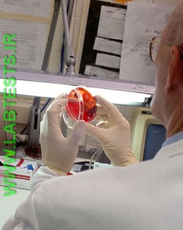 A lab professional examines the culture