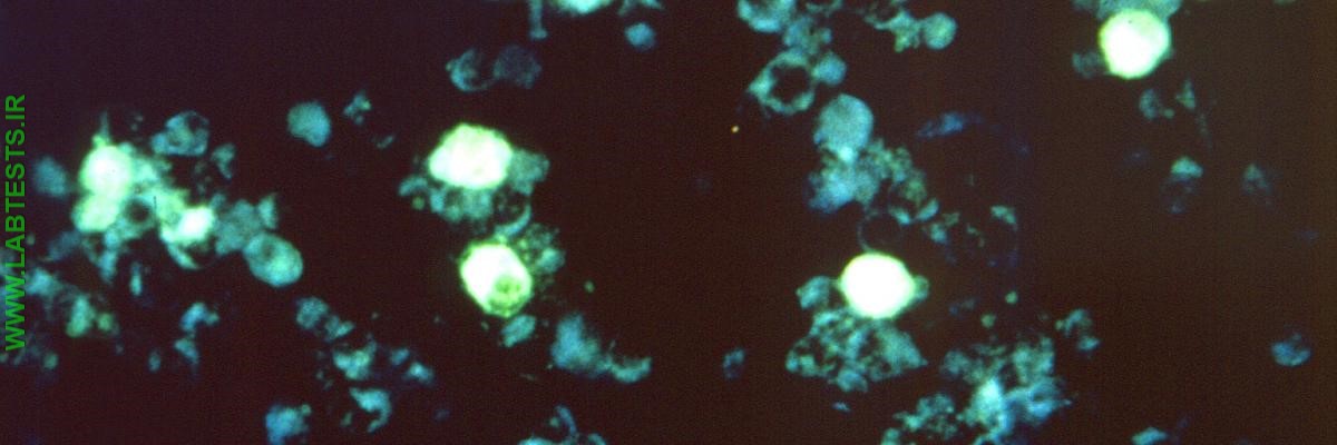 EBV particles