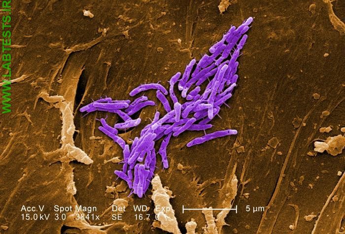 Image of M. Fortuitum