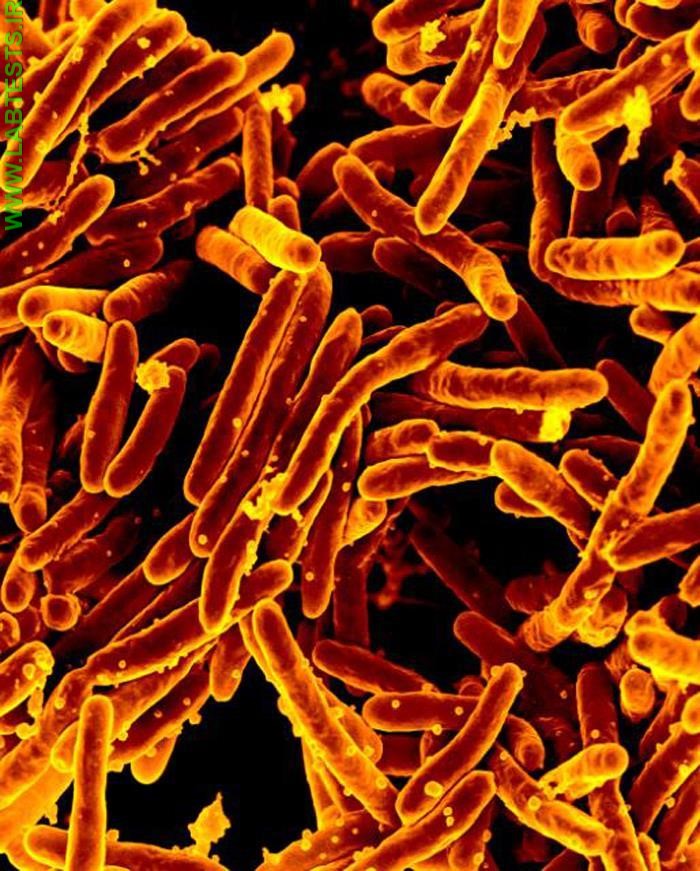 Mycobacterium tuberculosis