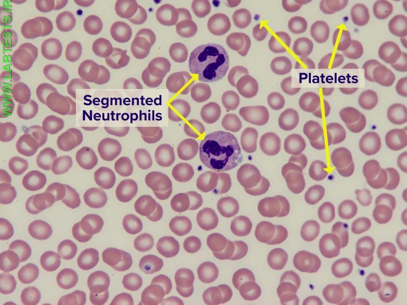 Blood smear showing RBCs, WBCs, platelets