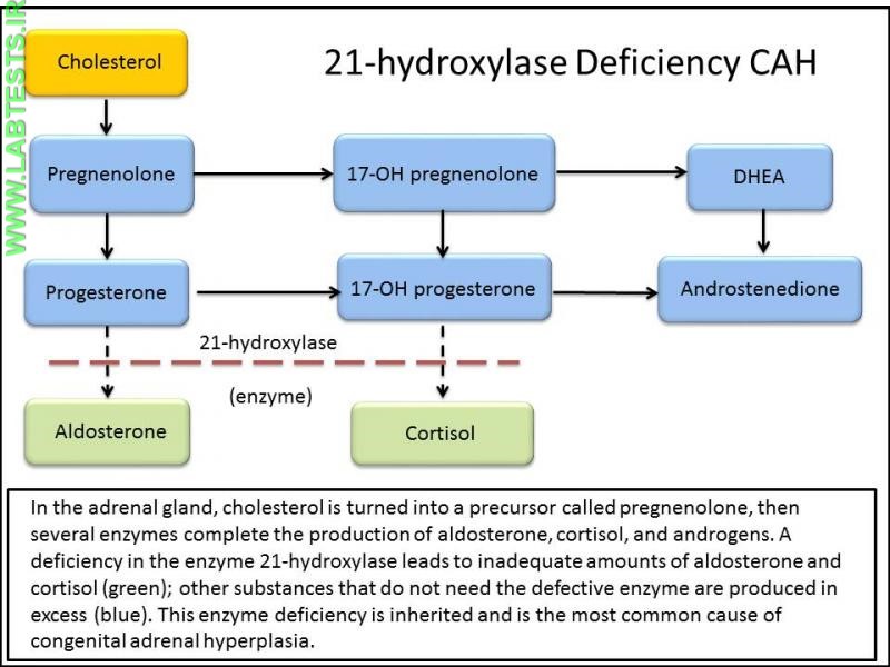 21 Hydroxylase Deficiency