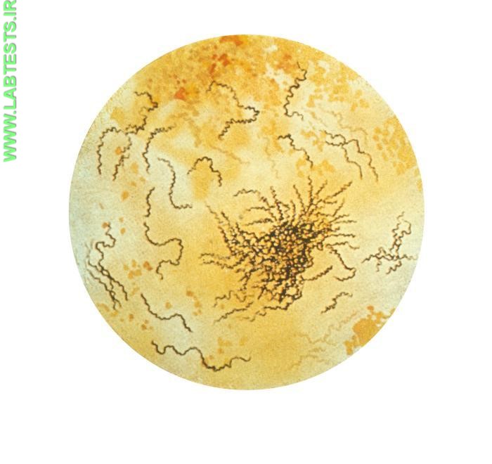 Image of syphilis bacteria