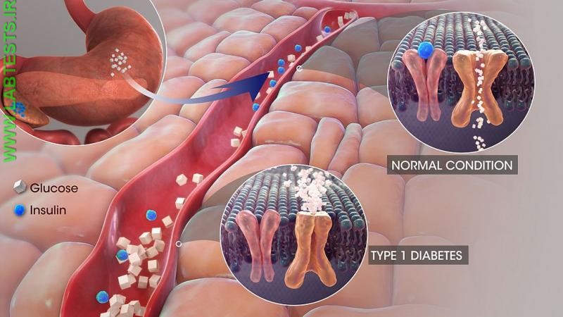 3d Animation of Diabetes Still