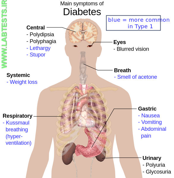 DIagram of Diabetes symptonms