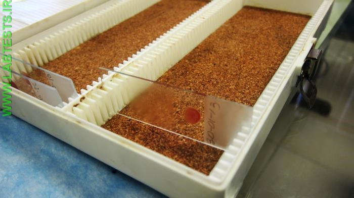 Blood smears for detecting malaria