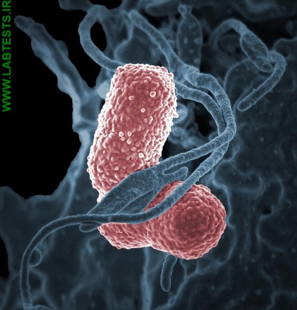 Photo of Klebsiella pneumoniae bacteria