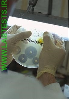 Testing a culture for treatment