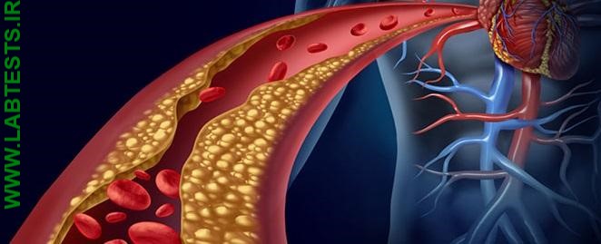 Plaque within an artery