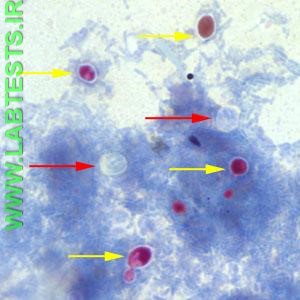 Cryptosporidium under the microscope
