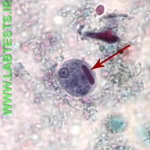 Entamoeba histolytica under the microscope