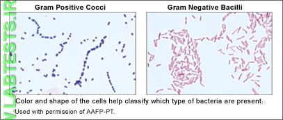 Image of Gram Stain