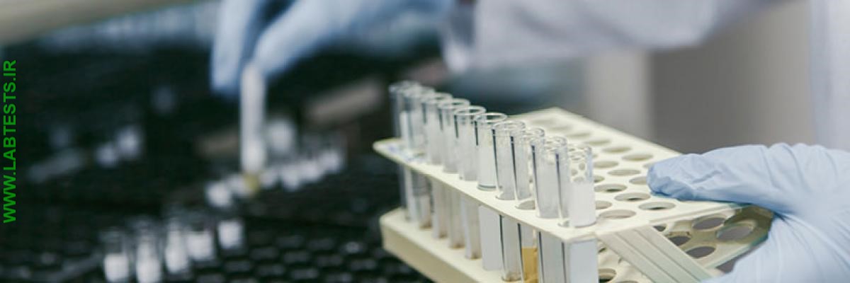 Commercial laboratory test