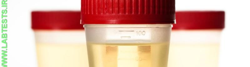 Urine samples for drug testing