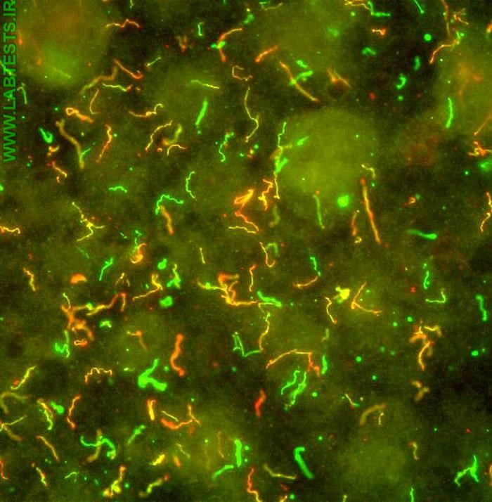 Borrelia bacteria