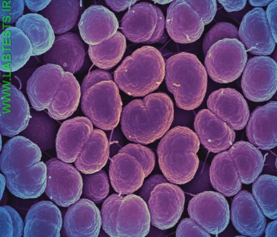 Photo of Gonorrhea bacteria
