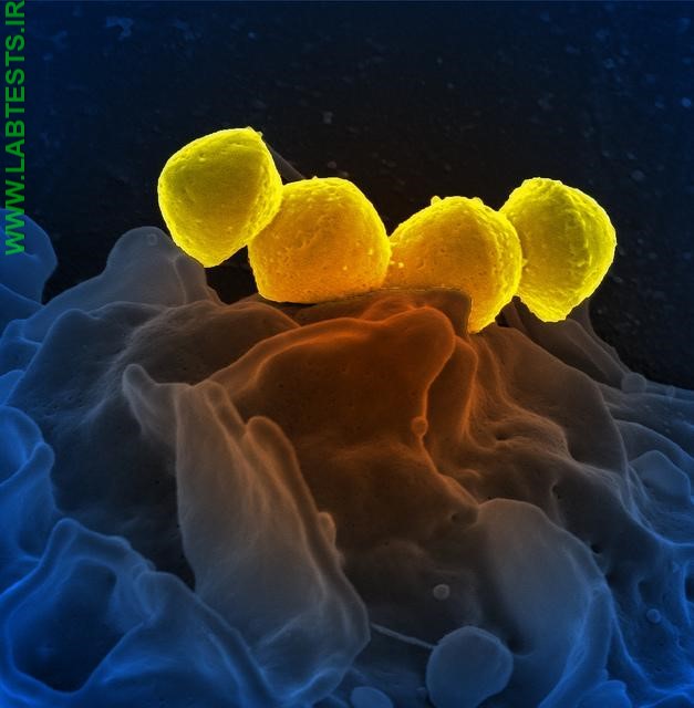 Image of group A strep