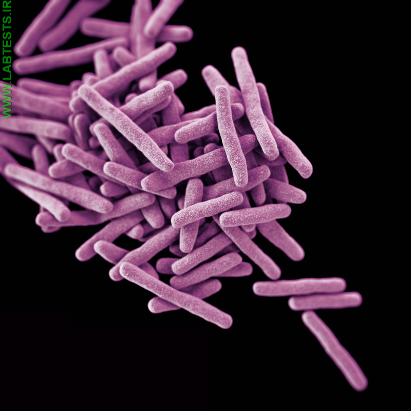 Photo of M. tuberculosis