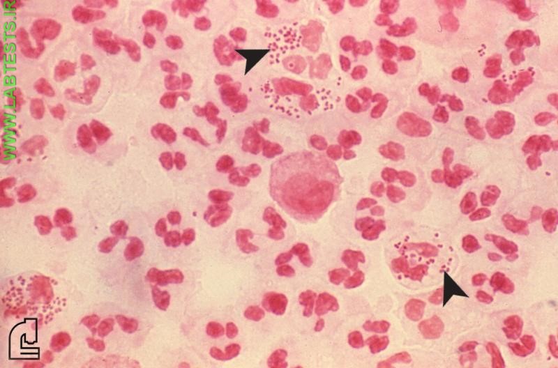 Gram negative cocci