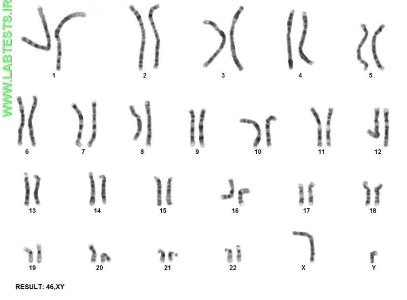 Photo of normal male karyotype