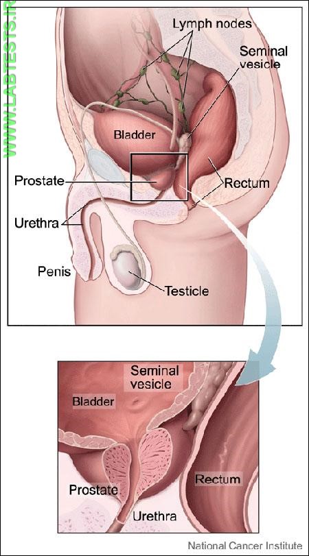 Location of the prostate gland