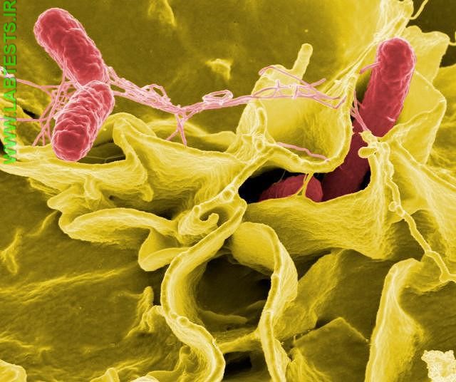 Salmonella bacteria photo