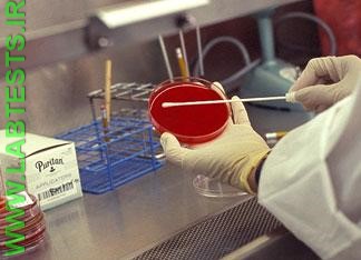 Preparing the culture