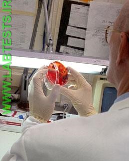 Inspecting a culture for growth of bacteria