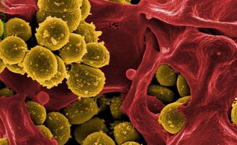 Antibiotic Resistance 